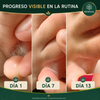 Jabón antimicótico Renova® Formula Original