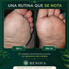 Jabón antimicótico Renova® Formula Original