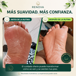 Jabón antimicótico Renova® Formula Original