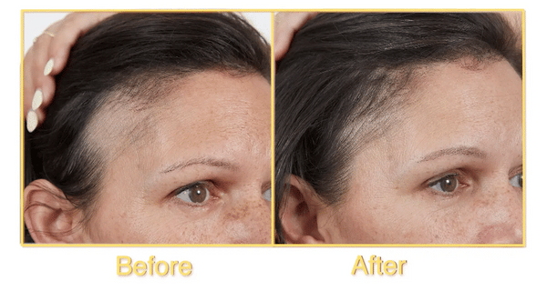 NeoCollagen BioPéptidos Potentes Naturales