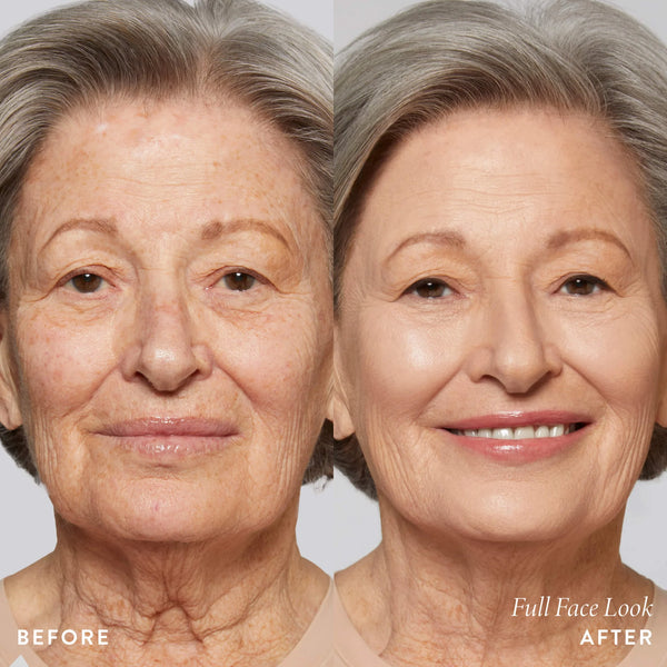 Rellenador Lineal Instantáneo Facial