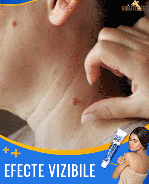 ChillErase Spray Renovador de Bultos